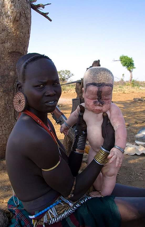 New born albino baby by a Masai woman.