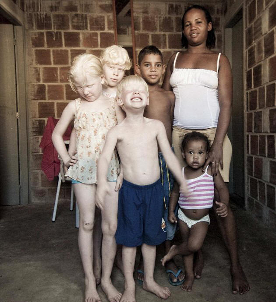 Reuters Photo - September 2009 Associated Newspapers, LTD Black Brazilian Parents have three Albino Children