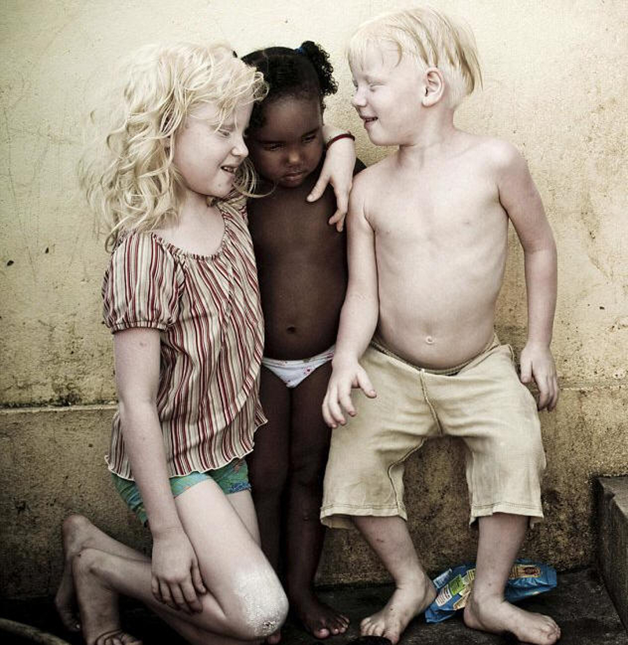 Reuters Photo – September 2009 Associated Newspapers, LTD Black Brazilian Parents have three Albino children.