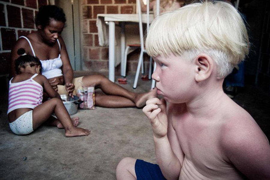 Reuters Photo – September 2009 Associated Newspapers, LTD Black Brazilian Parents have three Albino children.